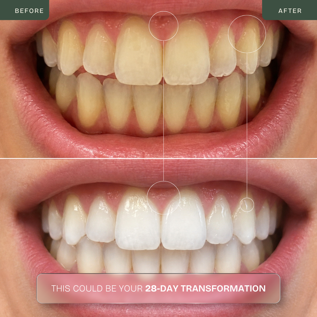 Pro Dual-Light Teeth Whitening Kit — Blue + Red LED