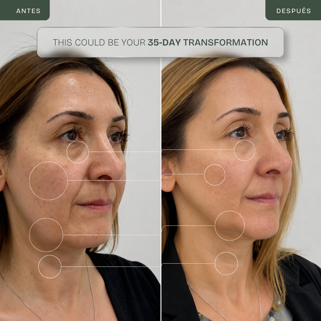 Lifting facial, firmeza e alívio da dor - LED infravermelho de 830 nm