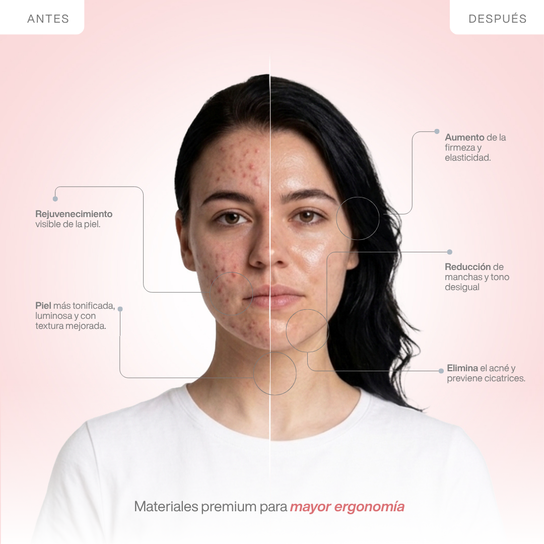 Lâmpada LED antienvelhecimento avançada - Tecnologia fotodinâmica (PDT)