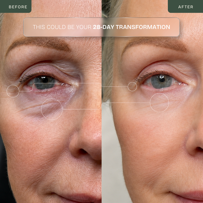 Corretor de Olhos RF em Ouro 24K